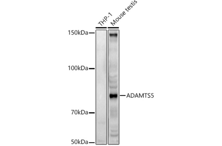 Western Blot - Anti-ADAMTS5 Antibody (A14217) - Antibodies.com