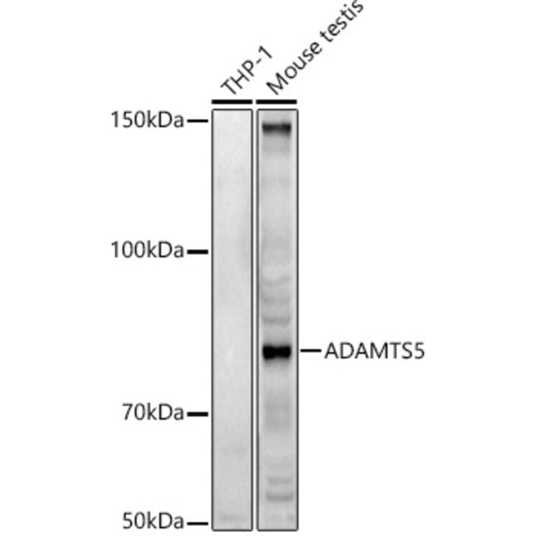 Western Blot - Anti-ADAMTS5 Antibody (A14217) - Antibodies.com