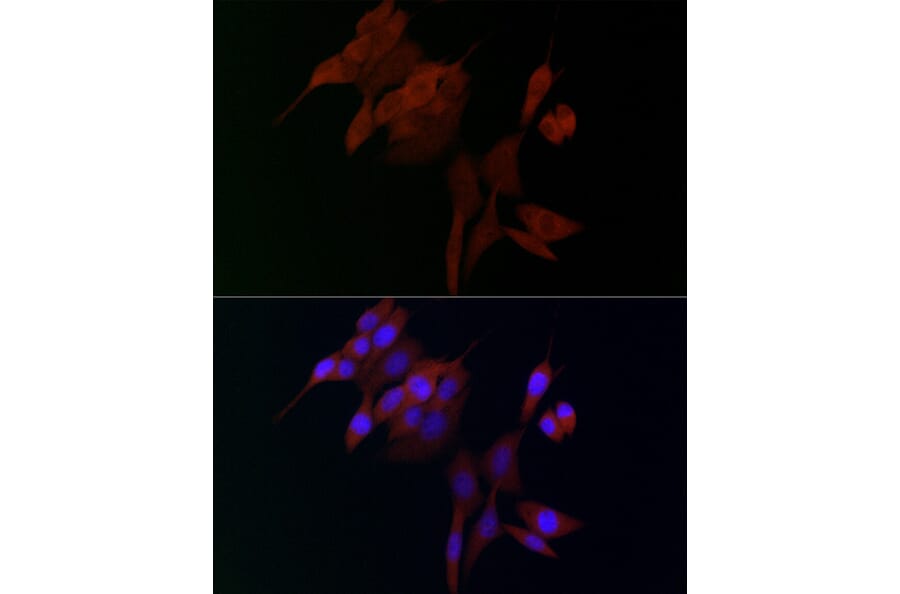Immunofluorescence - Anti-ADAMTS5 Antibody (A14217) - Antibodies.com