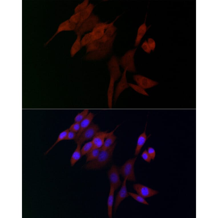 Immunofluorescence - Anti-ADAMTS5 Antibody (A14217) - Antibodies.com