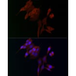 Immunofluorescence - Anti-ADAMTS5 Antibody (A14217) - Antibodies.com