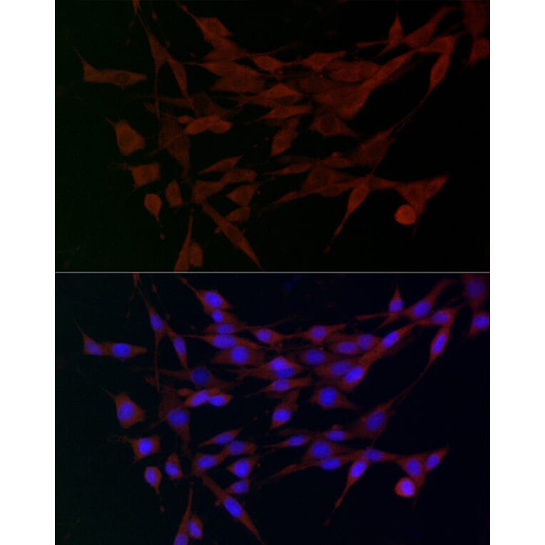 Immunofluorescence - Anti-ADAMTS5 Antibody (A14217) - Antibodies.com