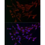 Immunofluorescence - Anti-ADAMTS5 Antibody (A14217) - Antibodies.com