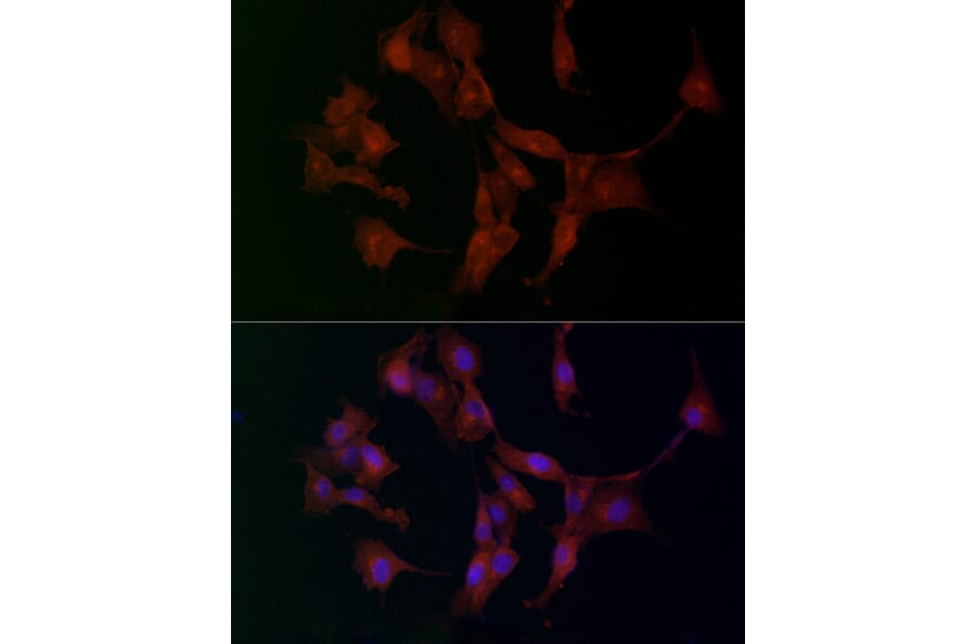 Immunofluorescence - Anti-ADAMTS5 Antibody (A14217) - Antibodies.com
