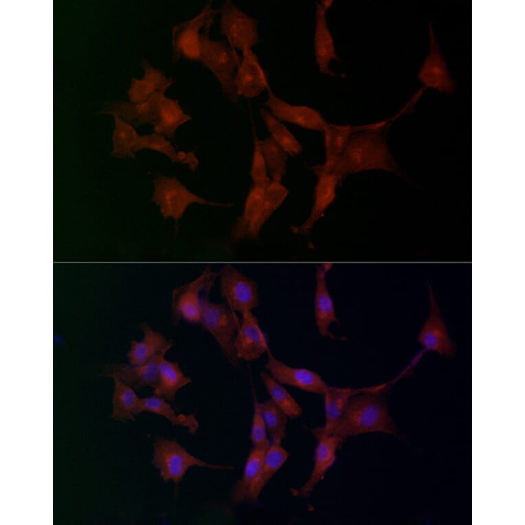 Immunofluorescence - Anti-ADAMTS5 Antibody (A14217) - Antibodies.com