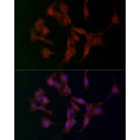 Immunofluorescence - Anti-ADAMTS5 Antibody (A14217) - Antibodies.com