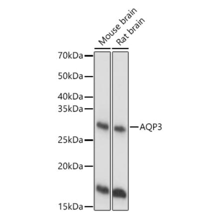Western Blot - Anti-Aquaporin 3 Antibody (A14218) - Antibodies.com