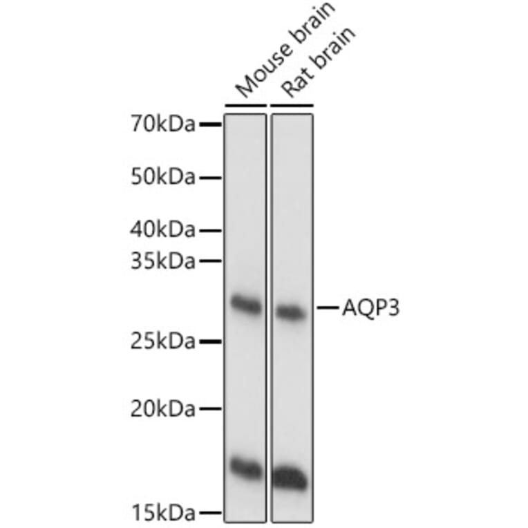 Western Blot - Anti-Aquaporin 3 Antibody (A14218) - Antibodies.com