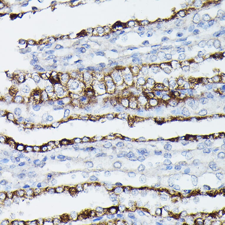 Immunohistochemistry - Anti-Aquaporin 3 Antibody (A14218) - Antibodies.com