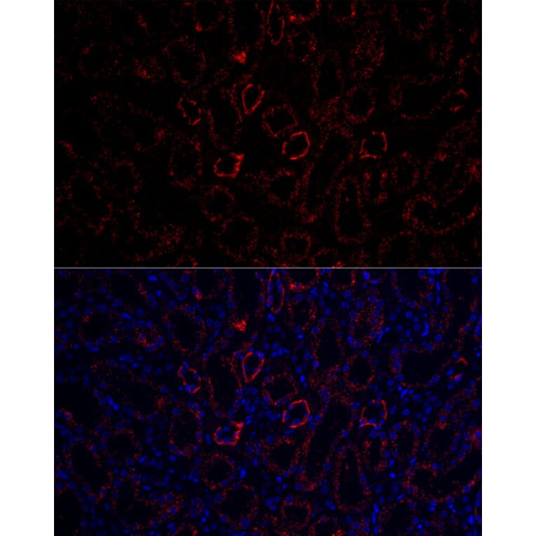 Immunofluorescence - Anti-Aquaporin 3 Antibody (A14218) - Antibodies.com