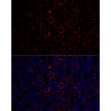 Immunofluorescence - Anti-Aquaporin 3 Antibody (A14218) - Antibodies.com