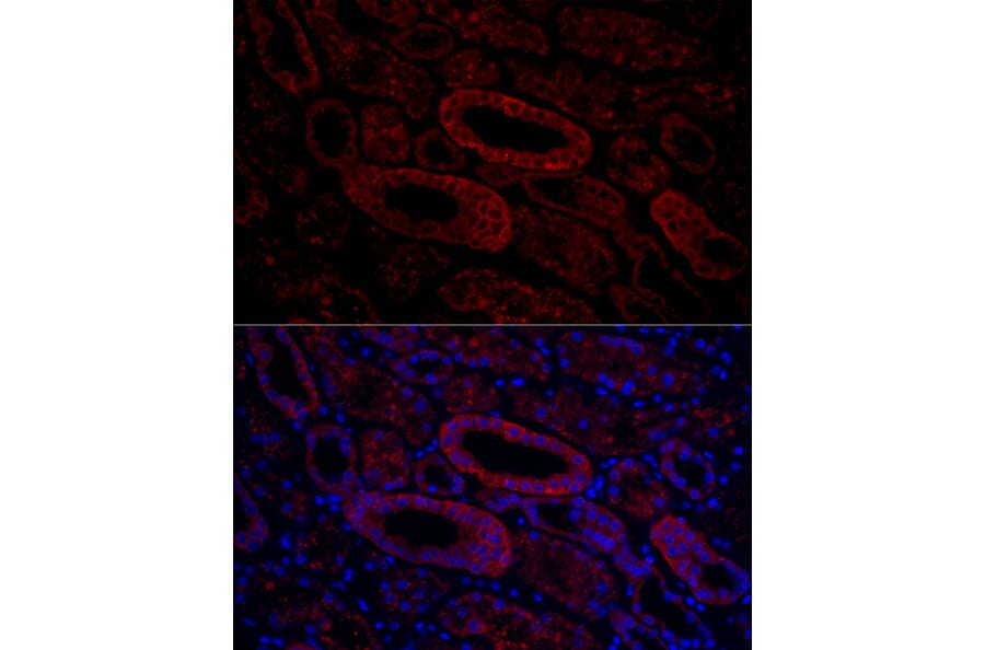 Immunofluorescence - Anti-Aquaporin 3 Antibody (A14218) - Antibodies.com