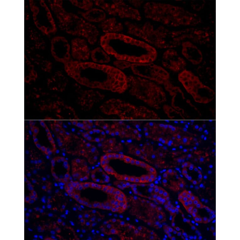 Immunofluorescence - Anti-Aquaporin 3 Antibody (A14218) - Antibodies.com