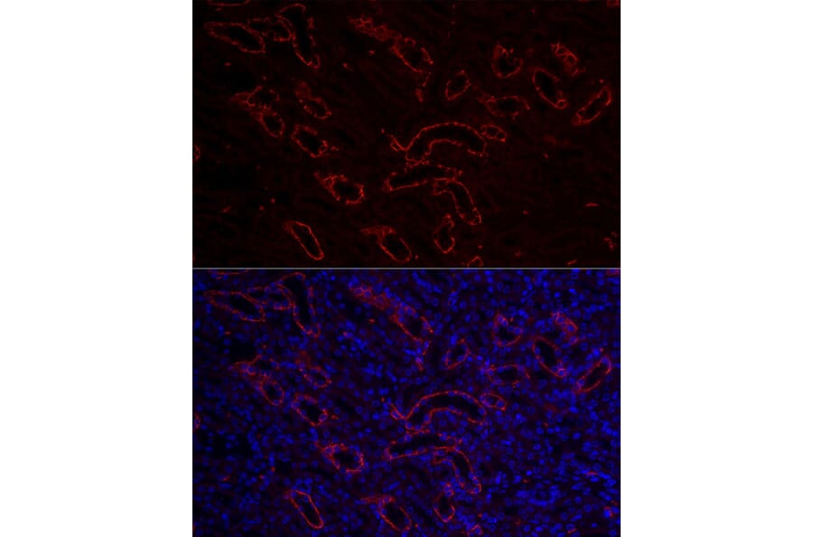 Immunofluorescence - Anti-Aquaporin 3 Antibody (A14218) - Antibodies.com