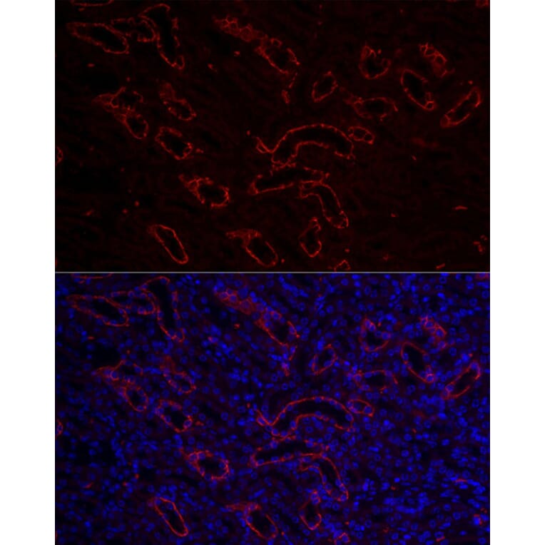 Immunofluorescence - Anti-Aquaporin 3 Antibody (A14218) - Antibodies.com