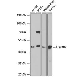 Western Blot - Anti-B2R Antibody (A14221) - Antibodies.com