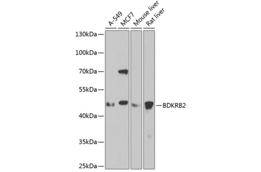 Western Blot - Anti-B2R Antibody (A14221) - Antibodies.com