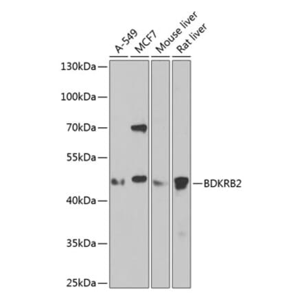 Western Blot - Anti-B2R Antibody (A14221) - Antibodies.com