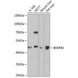 Western Blot - Anti-B2R Antibody (A14221) - Antibodies.com