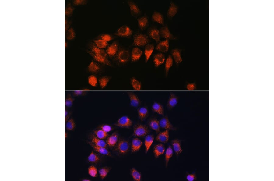 Immunofluorescence - Anti-B2R Antibody (A14221) - Antibodies.com