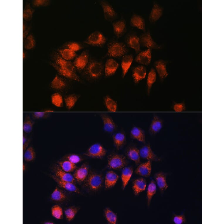 Immunofluorescence - Anti-B2R Antibody (A14221) - Antibodies.com