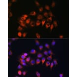 Immunofluorescence - Anti-B2R Antibody (A14221) - Antibodies.com