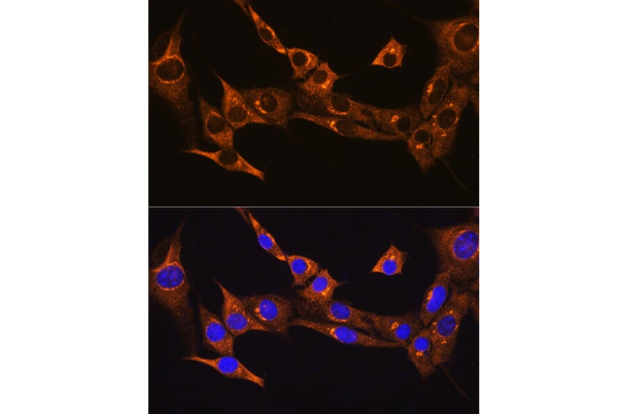 Immunofluorescence - Anti-B2R Antibody (A14221) - Antibodies.com