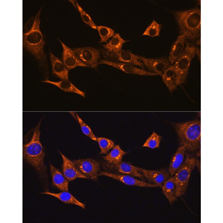 Immunofluorescence - Anti-B2R Antibody (A14221) - Antibodies.com