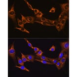 Immunofluorescence - Anti-B2R Antibody (A14221) - Antibodies.com