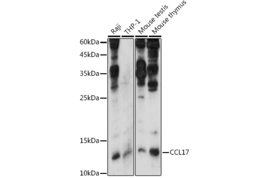 Western Blot - Anti-TARC/CCL17 Antibody (A14223) - Antibodies.com