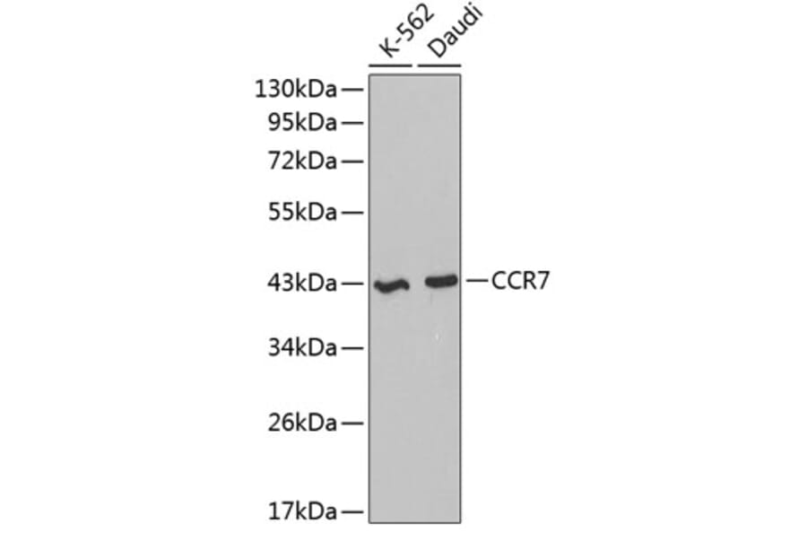 Western Blot - Anti-CCR7 Antibody (A2857) - Antibodies.com