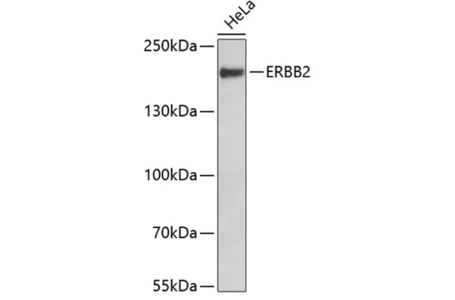 Western Blot - Anti-ERBB2 Antibody (A2863) - Antibodies.com