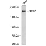 Western Blot - Anti-ERBB2 Antibody (A2863) - Antibodies.com
