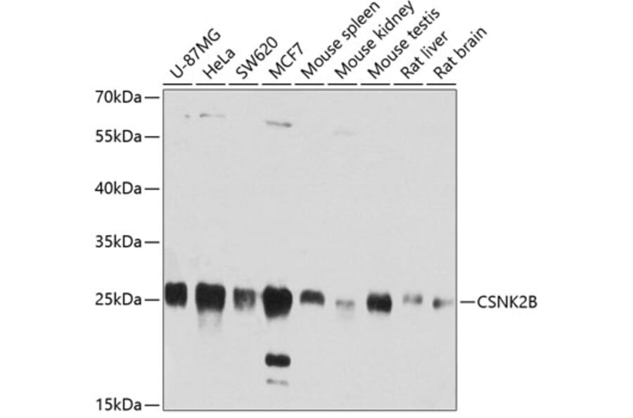 Western Blot - Anti-CSNK2B Antibody (A2869) - Antibodies.com