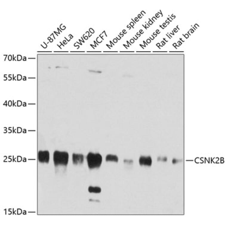 Western Blot - Anti-CSNK2B Antibody (A2869) - Antibodies.com