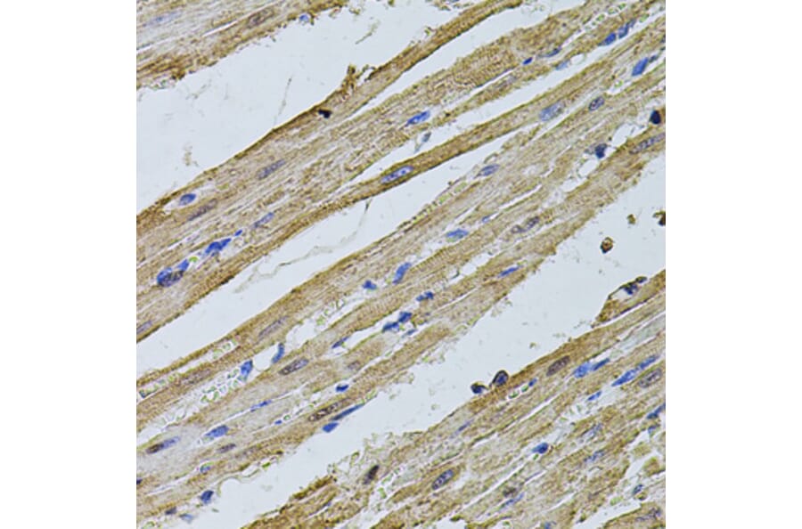 Immunohistochemistry - Anti-CSNK2B Antibody (A2869) - Antibodies.com