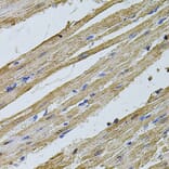 Immunohistochemistry - Anti-CSNK2B Antibody (A2869) - Antibodies.com