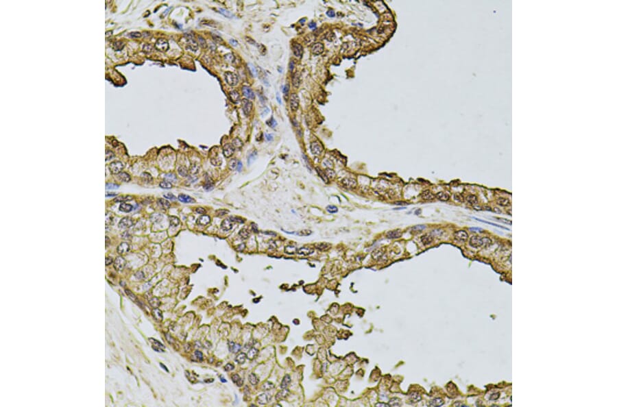 Immunohistochemistry - Anti-CSNK2B Antibody (A2869) - Antibodies.com