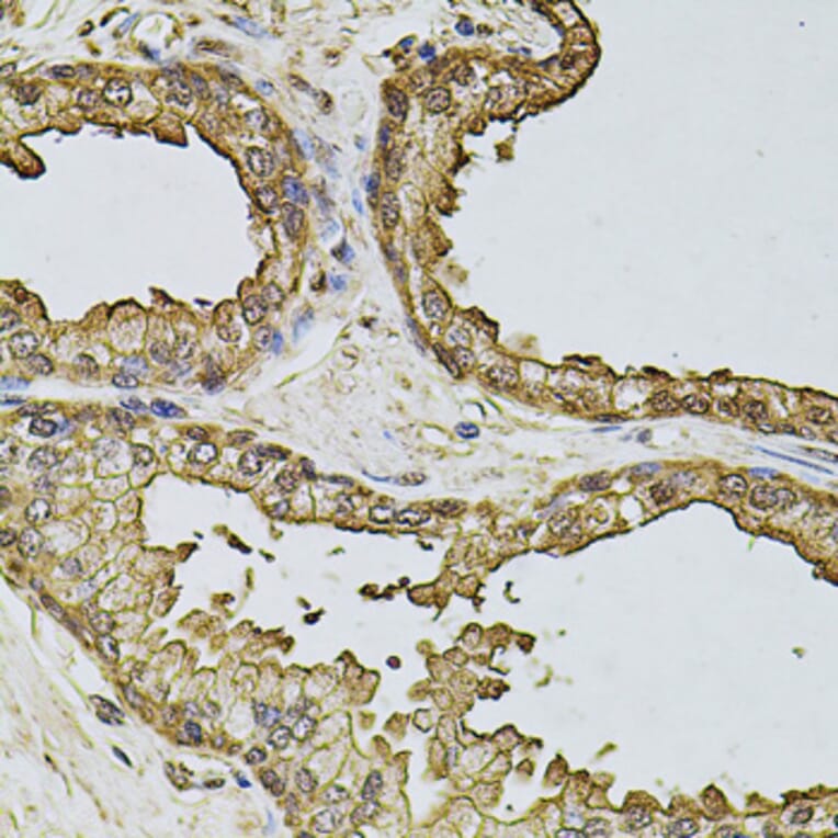 Immunohistochemistry - Anti-CSNK2B Antibody (A2869) - Antibodies.com