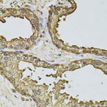 Immunohistochemistry - Anti-CSNK2B Antibody (A2869) - Antibodies.com