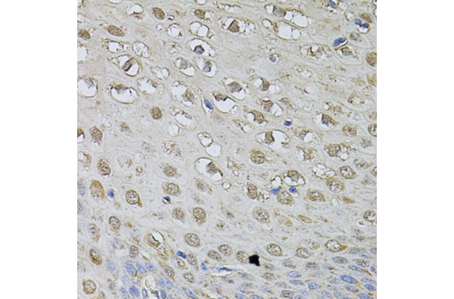 Immunohistochemistry - Anti-CSNK2B Antibody (A2869) - Antibodies.com
