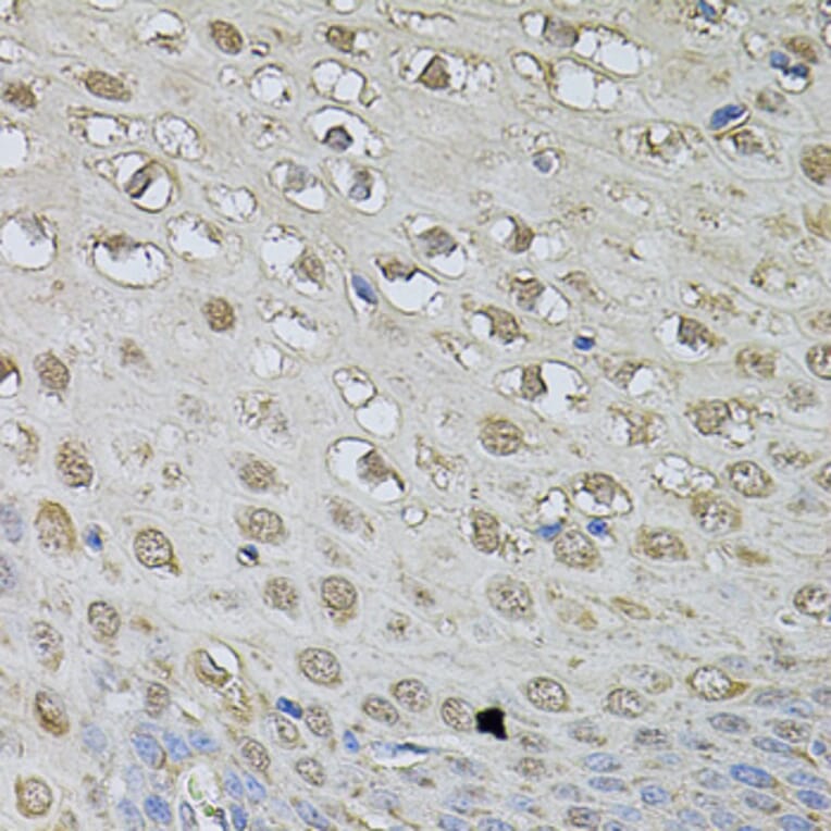 Immunohistochemistry - Anti-CSNK2B Antibody (A2869) - Antibodies.com