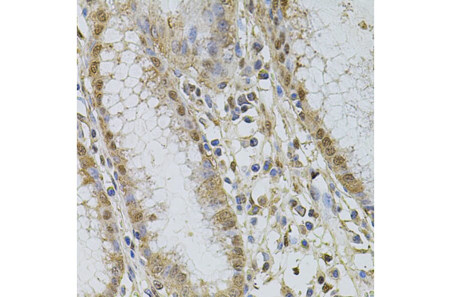 Immunohistochemistry - Anti-CSNK2B Antibody (A2869) - Antibodies.com