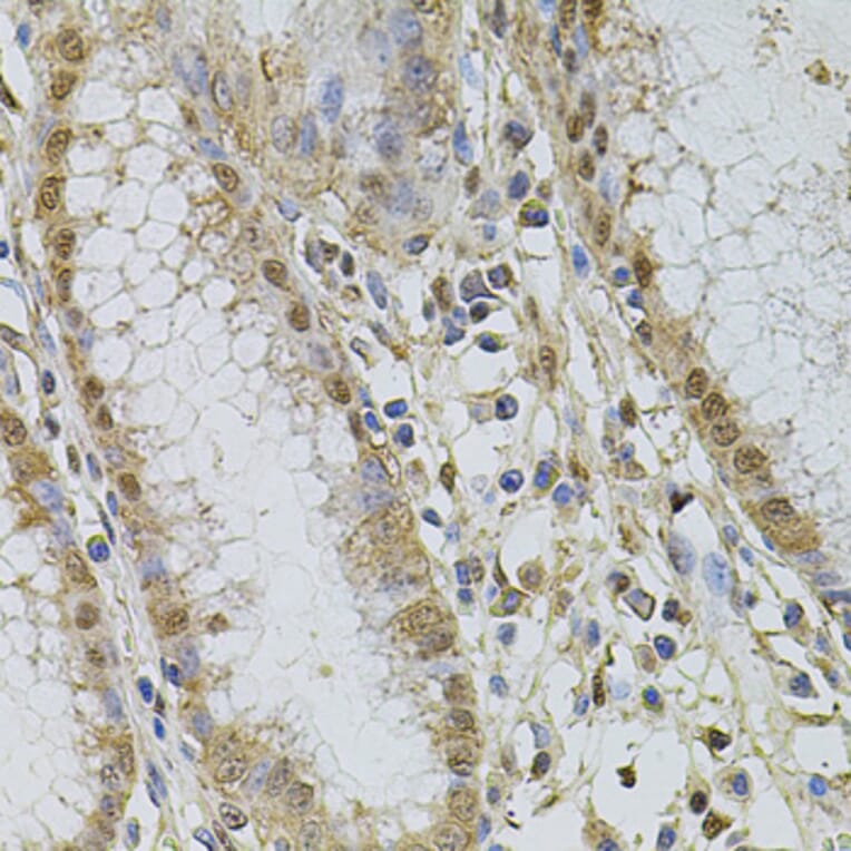 Immunohistochemistry - Anti-CSNK2B Antibody (A2869) - Antibodies.com