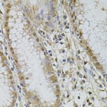 Immunohistochemistry - Anti-CSNK2B Antibody (A2869) - Antibodies.com