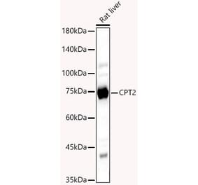Western Blot - Anti-CPT2 Antibody (A14229) - Antibodies.com