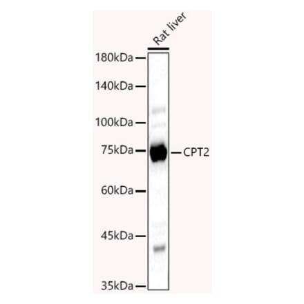 Western Blot - Anti-CPT2 Antibody (A14229) - Antibodies.com