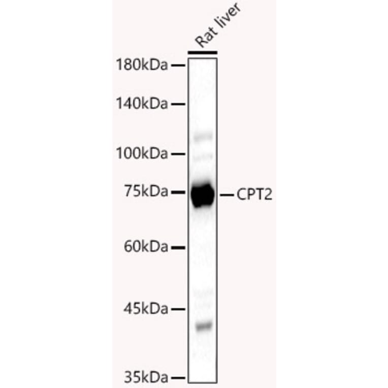 Western Blot - Anti-CPT2 Antibody (A14229) - Antibodies.com