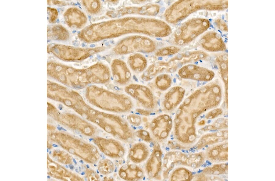 Immunohistochemistry - Anti-CPT2 Antibody (A14229) - Antibodies.com