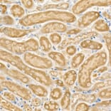 Immunohistochemistry - Anti-CPT2 Antibody (A14229) - Antibodies.com